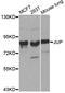 Junction Plakoglobin antibody, A0963, ABclonal Technology, Western Blot image 
