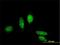 Metastasis Associated 1 Family Member 3 antibody, H00057504-M02, Novus Biologicals, Immunocytochemistry image 