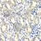 Prostaglandin E Synthase 2 antibody, A7137, ABclonal Technology, Immunohistochemistry paraffin image 