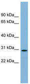NKAP Domain Containing 1 antibody, TA344914, Origene, Western Blot image 