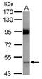 Cytochrome P450 Family 3 Subfamily A Member 7 antibody, LS-C155226, Lifespan Biosciences, Western Blot image 
