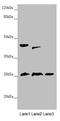 RING finger protein 114 antibody, LS-C676400, Lifespan Biosciences, Western Blot image 
