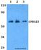 Adhesion G Protein-Coupled Receptor A1 antibody, LS-C411947, Lifespan Biosciences, Western Blot image 