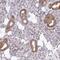 Mitochondrial Ribosomal Protein L21 antibody, HPA051657, Atlas Antibodies, Immunohistochemistry paraffin image 