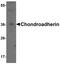 Chondroadherin antibody, TA355009, Origene, Western Blot image 