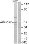 Monoacylglycerol lipase ABHD12 antibody, PA5-38994, Invitrogen Antibodies, Western Blot image 