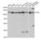 SH2B Adaptor Protein 1 antibody, abx004263, Abbexa, Western Blot image 