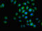 Very long-chain specific acyl-CoA dehydrogenase, mitochondrial antibody, LS-C669669, Lifespan Biosciences, Immunofluorescence image 