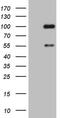 ADAM Metallopeptidase With Thrombospondin Type 1 Motif 4 antibody, MA5-26715, Invitrogen Antibodies, Western Blot image 