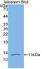 Vascular Endothelial Growth Factor D antibody, LS-C297944, Lifespan Biosciences, Western Blot image 
