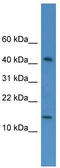 Chromosome 19 Open Reading Frame 73 antibody, TA344927, Origene, Western Blot image 
