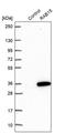 RAB15, Member RAS Oncogene Family antibody, PA5-59468, Invitrogen Antibodies, Western Blot image 