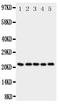 Syndecan 2 antibody, PA1896, Boster Biological Technology, Western Blot image 