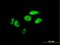Zinc Finger And SCAN Domain Containing 26 antibody, H00007741-B01P, Novus Biologicals, Immunocytochemistry image 