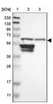 Ribophorin II antibody, PA5-52540, Invitrogen Antibodies, Western Blot image 