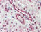 Solute Carrier Family 44 Member 2 antibody, TA317334, Origene, Immunohistochemistry paraffin image 