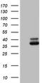 Ornithine Carbamoyltransferase antibody, TA802397S, Origene, Western Blot image 