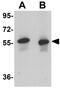 Spindle And Kinetochore Associated Complex Subunit 3 antibody, GTX85013, GeneTex, Western Blot image 