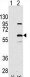 Elongator complex protein 3 antibody, abx026105, Abbexa, Western Blot image 
