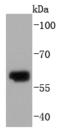 Collagen Type X Alpha 1 Chain antibody, A01026, Boster Biological Technology, Western Blot image 