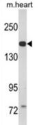 Atrial natriuretic peptide-converting enzyme antibody, abx033031, Abbexa, Western Blot image 