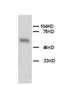 Alkaline Phosphatase, Biomineralization Associated antibody, ab65834, Abcam, Western Blot image 