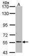 Alkaline Phosphatase, Germ Cell antibody, TA308201, Origene, Western Blot image 