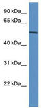 Jumonji Domain Containing 4 antibody, TA333694, Origene, Western Blot image 