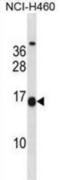 Mesogenin 1 antibody, abx028631, Abbexa, Western Blot image 