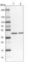 Vacuolar Protein Sorting 36 Homolog antibody, NBP2-13519, Novus Biologicals, Western Blot image 