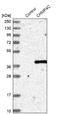 Charged Multivesicular Body Protein 4C antibody, NBP1-81166, Novus Biologicals, Western Blot image 