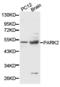 Parkin RBR E3 Ubiquitin Protein Ligase antibody, TA326867, Origene, Western Blot image 