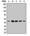 Ubiquinol-Cytochrome C Reductase Core Protein 1 antibody, orb412177, Biorbyt, Western Blot image 