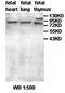Zinc Finger And BTB Domain Containing 1 antibody, orb77662, Biorbyt, Western Blot image 