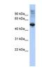F-Box And Leucine Rich Repeat Protein 16 antibody, NBP1-57613, Novus Biologicals, Western Blot image 