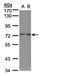 Replication protein A 70 kDa DNA-binding subunit antibody, LS-C186023, Lifespan Biosciences, Western Blot image 