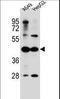 Acyl-CoA Synthetase Medium Chain Family Member 6 antibody, LS-C156910, Lifespan Biosciences, Western Blot image 