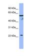 Karyopherin Subunit Alpha 6 antibody, orb330787, Biorbyt, Western Blot image 
