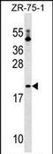 Peptidyl-TRNA Hydrolase 1 Homolog antibody, PA5-72015, Invitrogen Antibodies, Western Blot image 