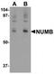 NUMB Endocytic Adaptor Protein antibody, TA319756, Origene, Western Blot image 