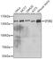 Splicing Factor 3b Subunit 2 antibody, A5875, ABclonal Technology, Western Blot image 