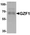 Zinc Finger MYM-Type Containing 4 antibody, orb75762, Biorbyt, Western Blot image 