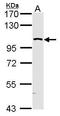 Mitogen-Activated Protein Kinase Kinase Kinase Kinase 5 antibody, TA308466, Origene, Western Blot image 
