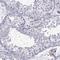Tubulin Epsilon And Delta Complex 2 antibody, HPA055389, Atlas Antibodies, Immunohistochemistry paraffin image 