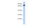 Zinc Finger Protein 221 antibody, 25-295, ProSci, Western Blot image 