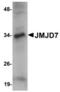 Jumonji Domain Containing 7 antibody, TA306836, Origene, Western Blot image 
