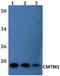 CKLF Like MARVEL Transmembrane Domain Containing 1 antibody, A11171-1, Boster Biological Technology, Western Blot image 