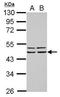 F-Box Protein 4 antibody, GTX115815, GeneTex, Western Blot image 
