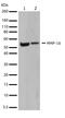 Matrix Metallopeptidase 16 antibody, 701306, Invitrogen Antibodies, Western Blot image 