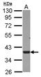 Ubiquitin carboxyl-terminal hydrolase 46 antibody, NBP2-20835, Novus Biologicals, Western Blot image 